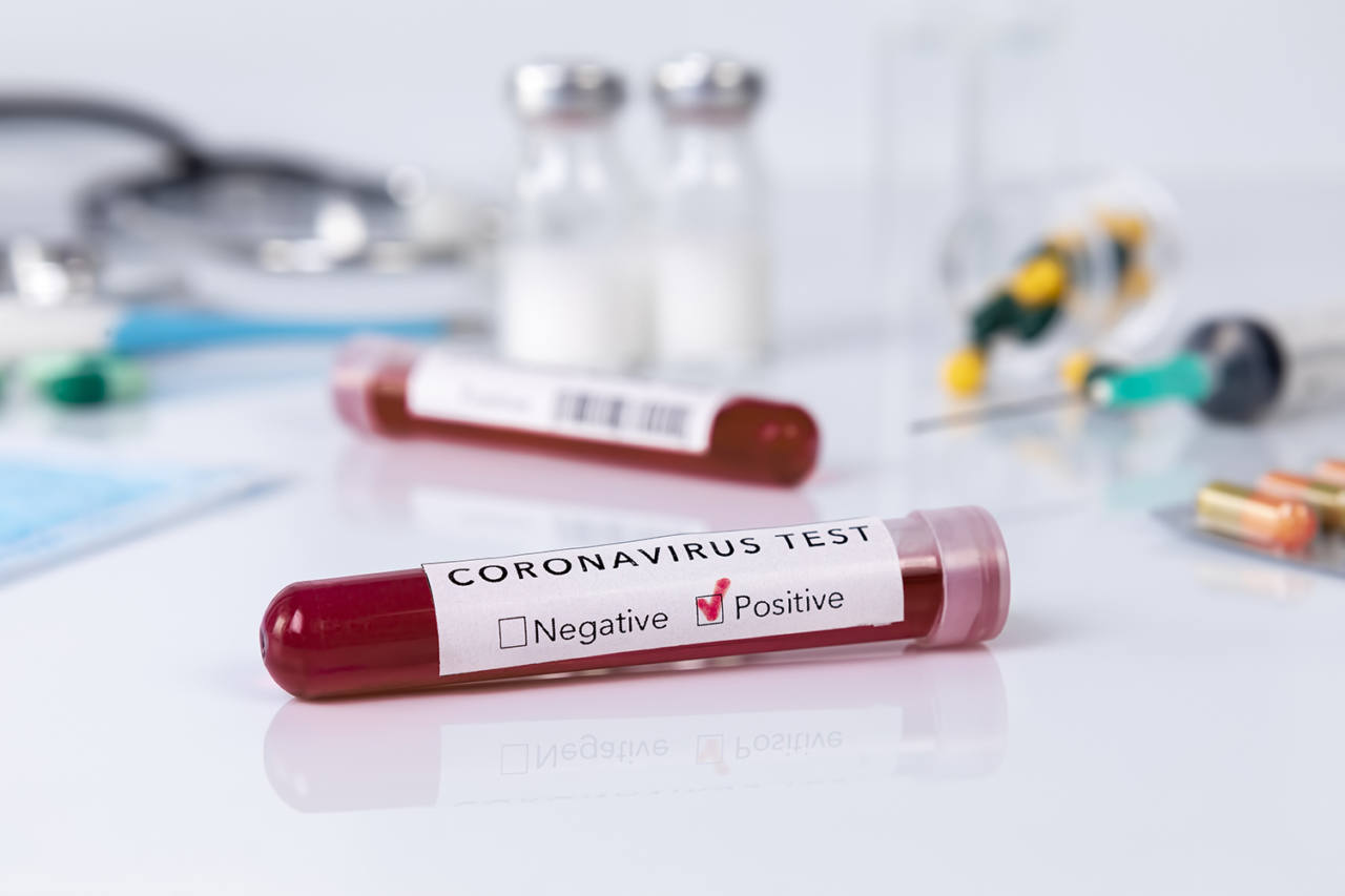 coronavirus, covid