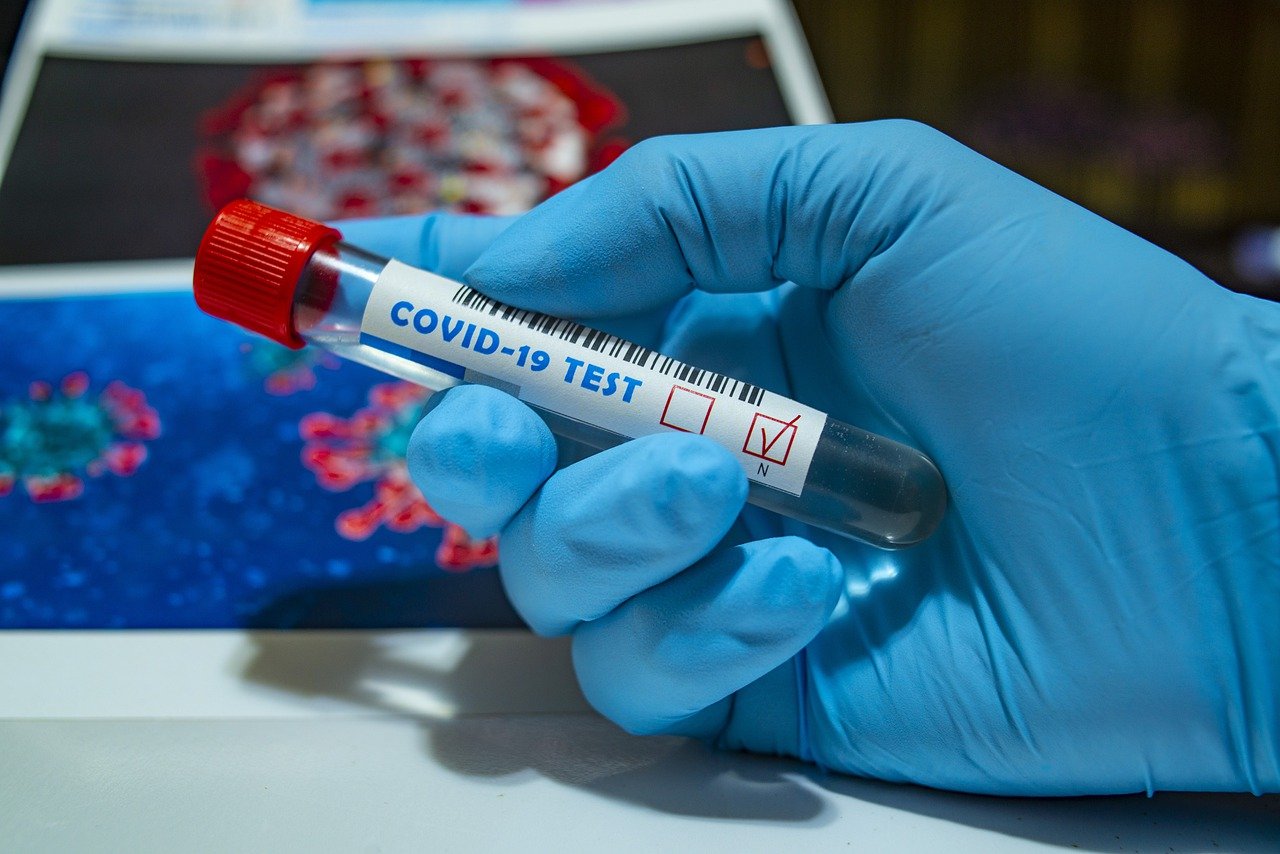 ancora contagi da coronavirus, covid-19, prelievi, test rapidi