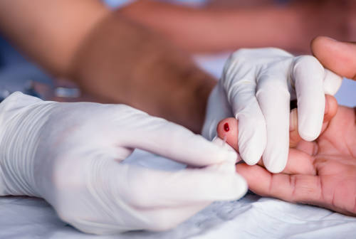 Hiv, epatiti e infezioni sessualmente trasmissibili: nelle Marche test gratuiti. Giacometti: «In crescita diagnosi di sifilide e gonorrea»