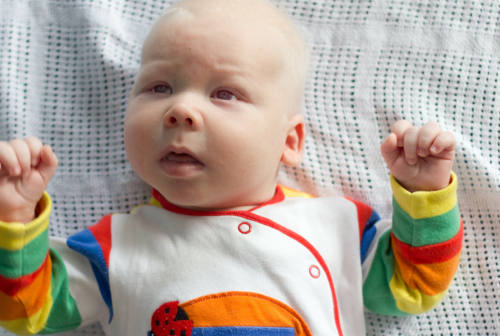 La vita da albini tra pregiudizi e difficoltà quotidiane